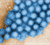 Norovirus. Photo: CDC/ Charles D. Humphrey, PhD