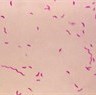 Campylobacterbakterier. Foto: CDC - Centers for Disease Control and Prevention
